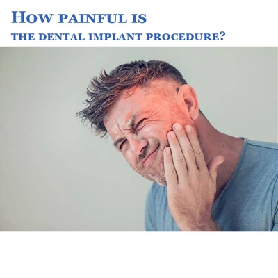 ¿Qué tan doloroso es el procedimiento de implante dental?